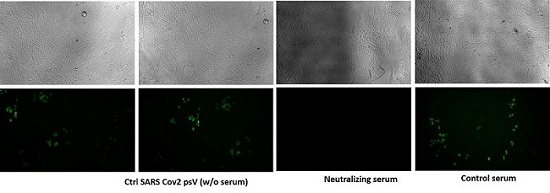 20201124_sars-cov2-neutralization_gfp-reporter_sm